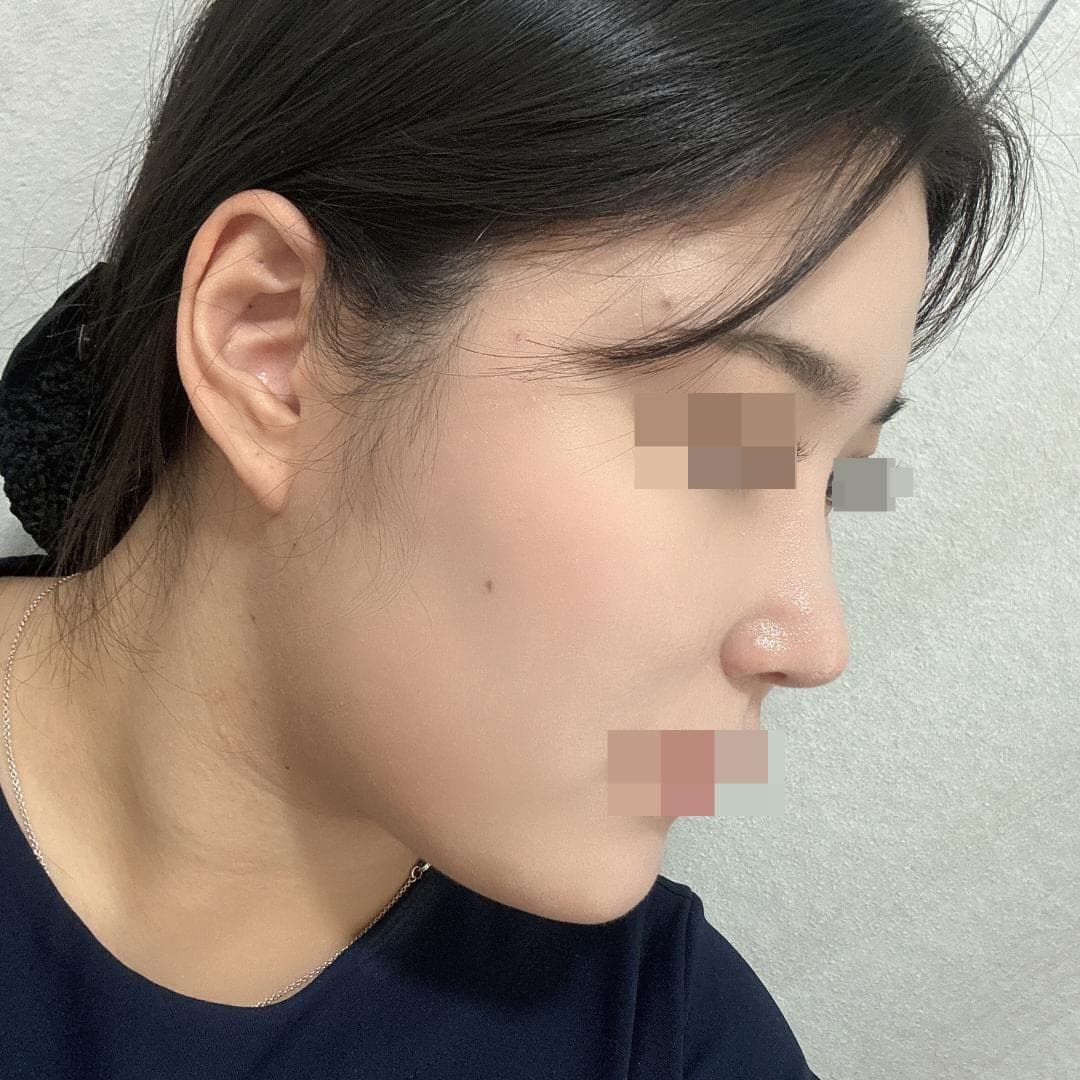 Menata ulang garis samping wajah