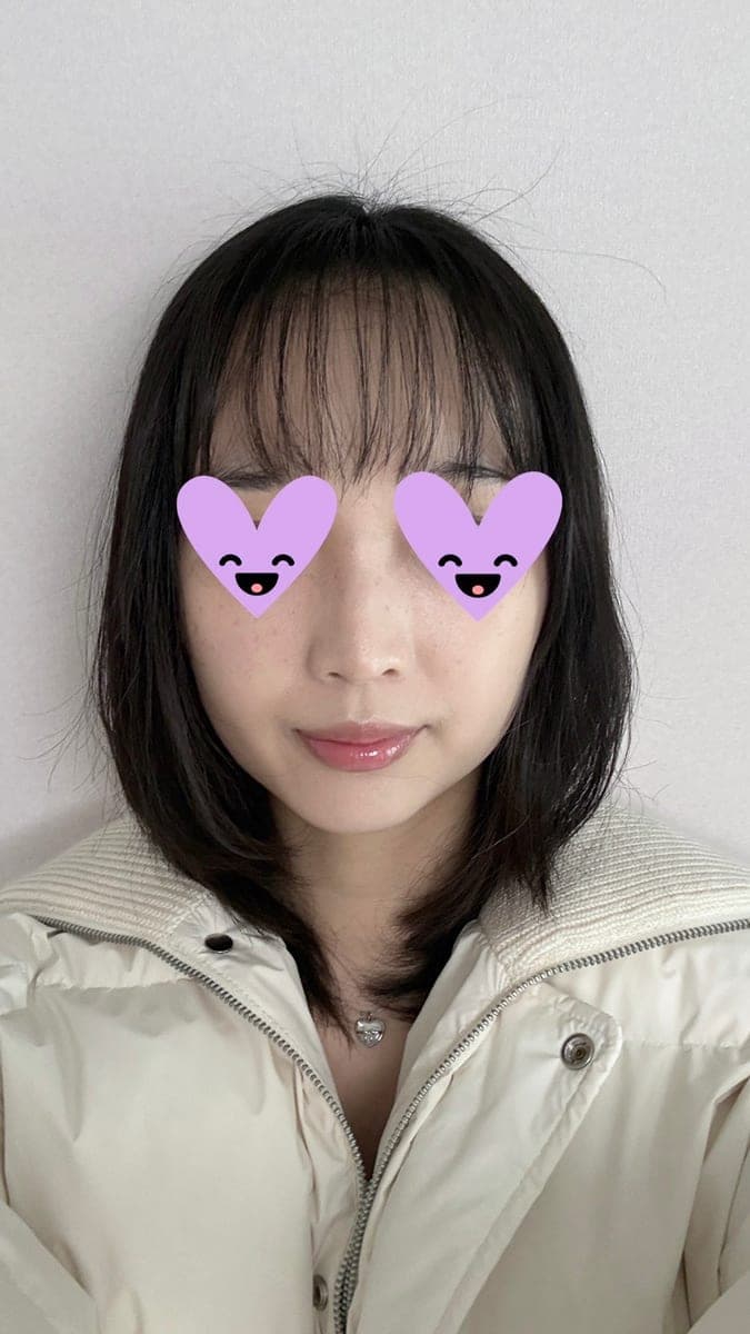 Hooked nose correction