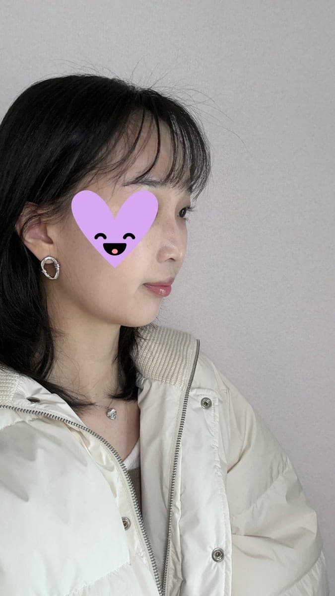 Hooked nose correction
