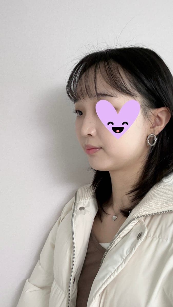 Hooked nose correction