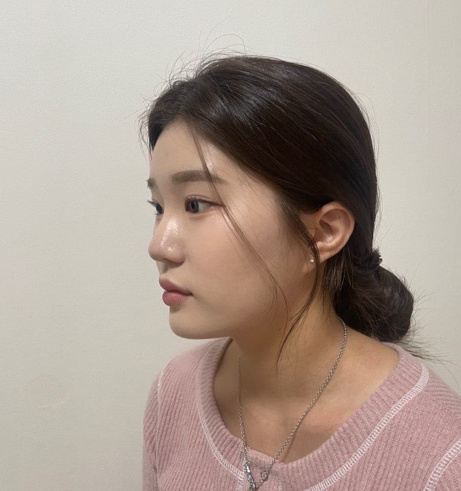 Menata ulang garis samping wajah