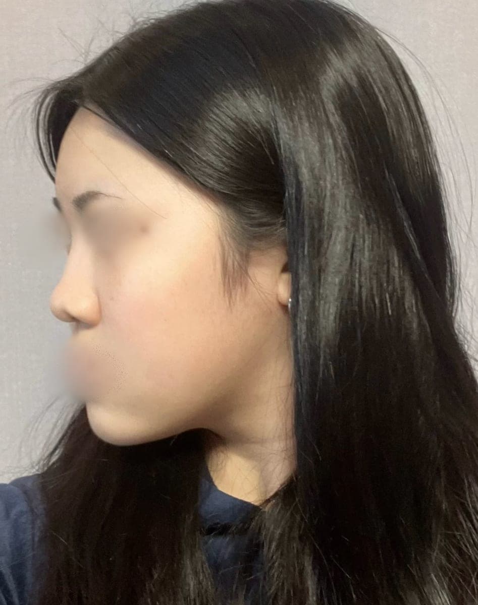 Kasus operasi ujung hidung