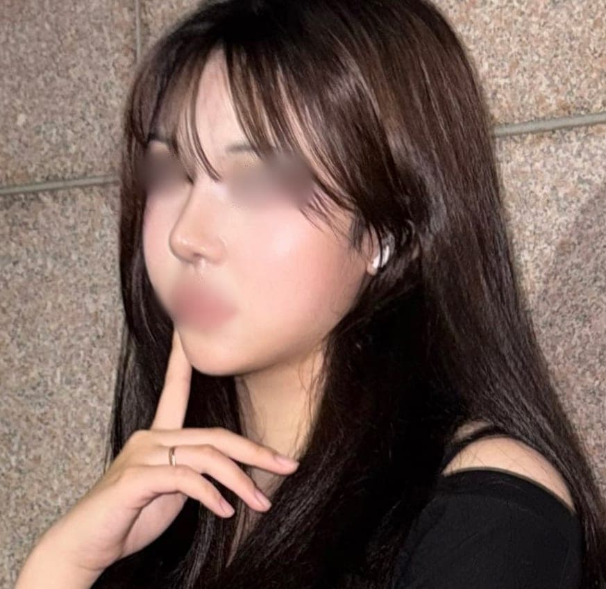 Kasus operasi ujung hidung