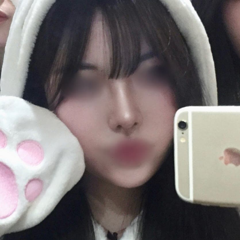 Kasus operasi ujung hidung