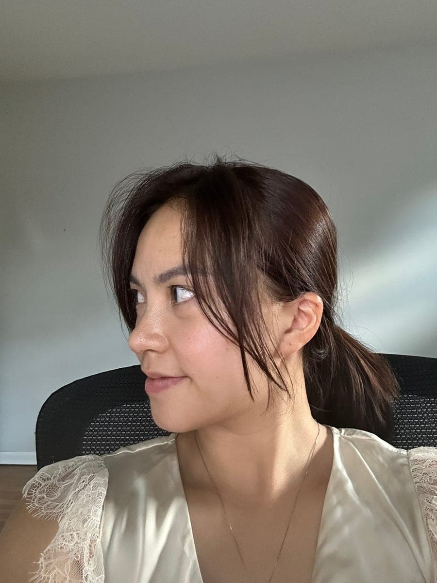 เสริมสันจมูกด้วยกระดูกอ่อนตัวเอง