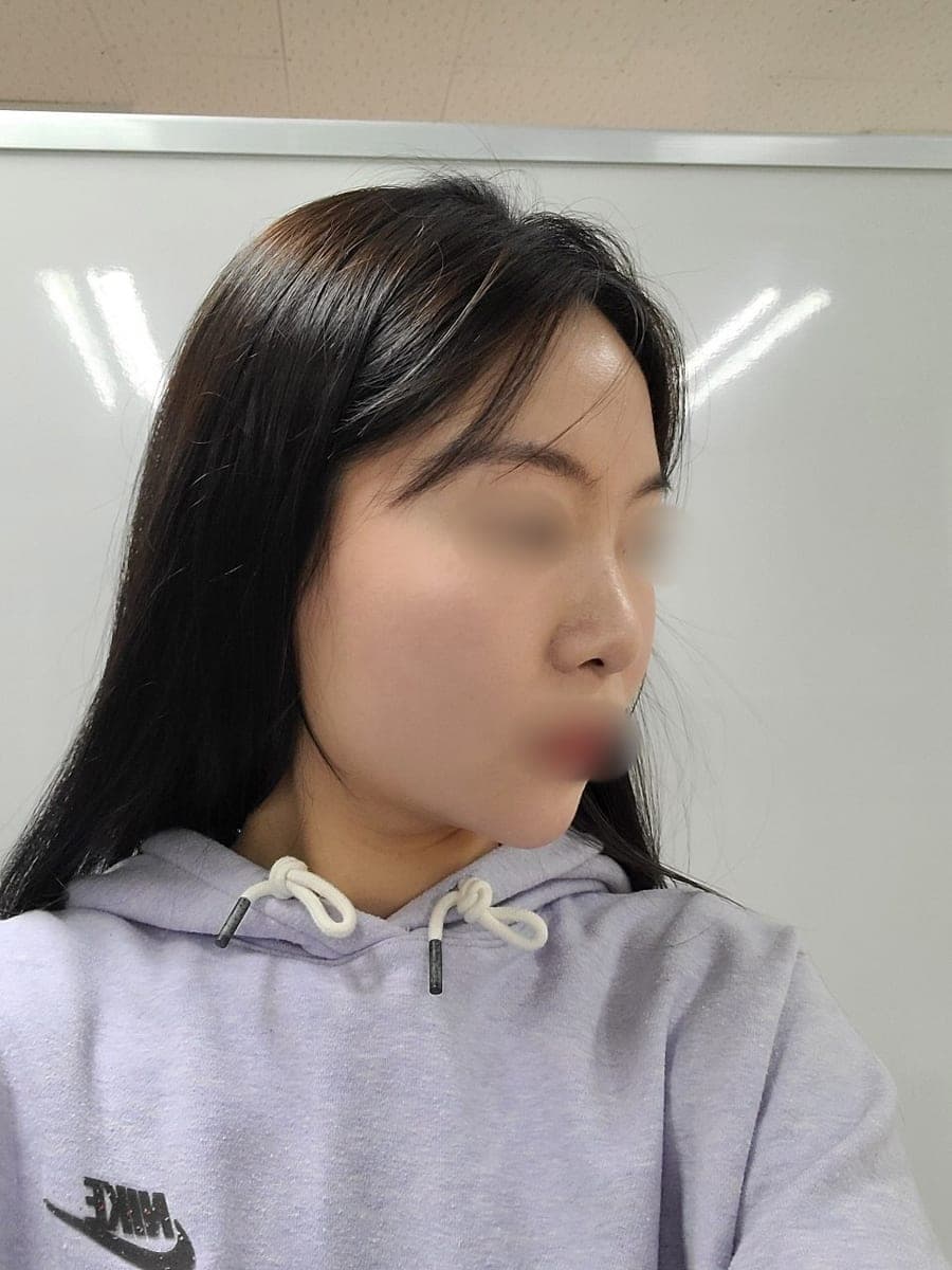 Less visible nostrils, tip with own cartilage