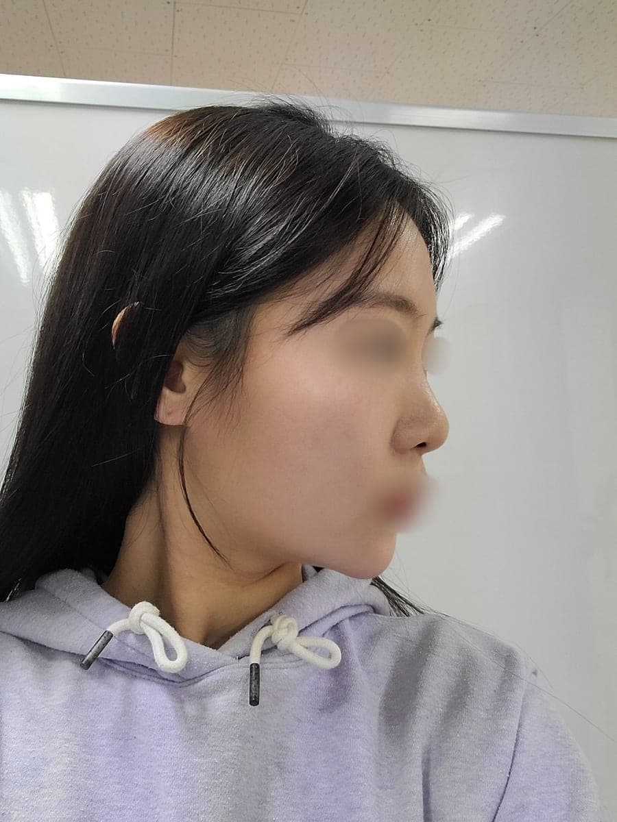 Less visible nostrils, tip with own cartilage