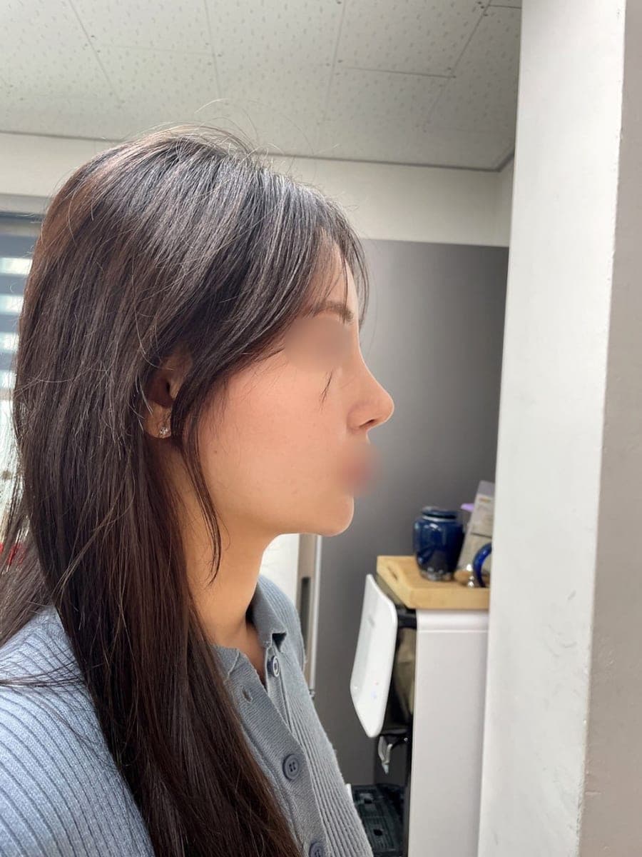 Less visible nostrils, tip with own cartilage