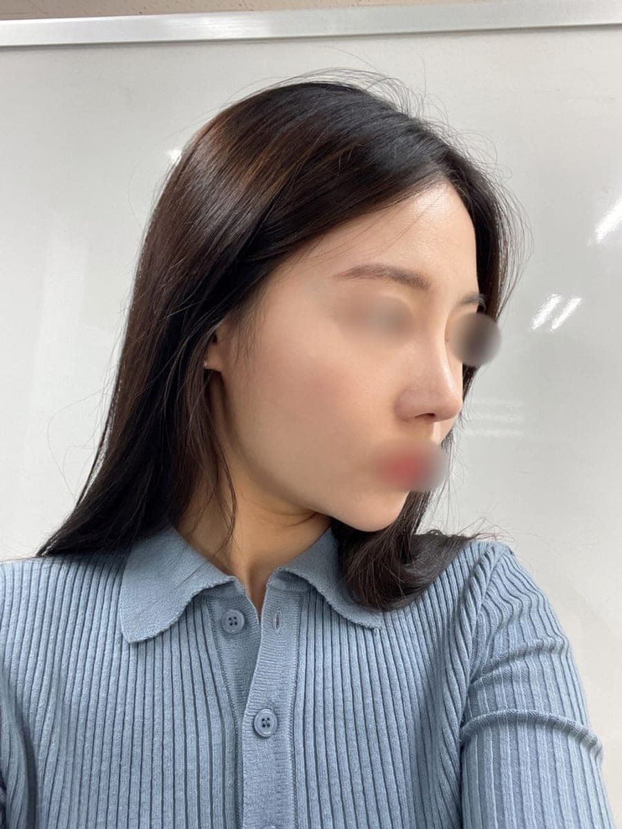 Less visible nostrils, tip with own cartilage