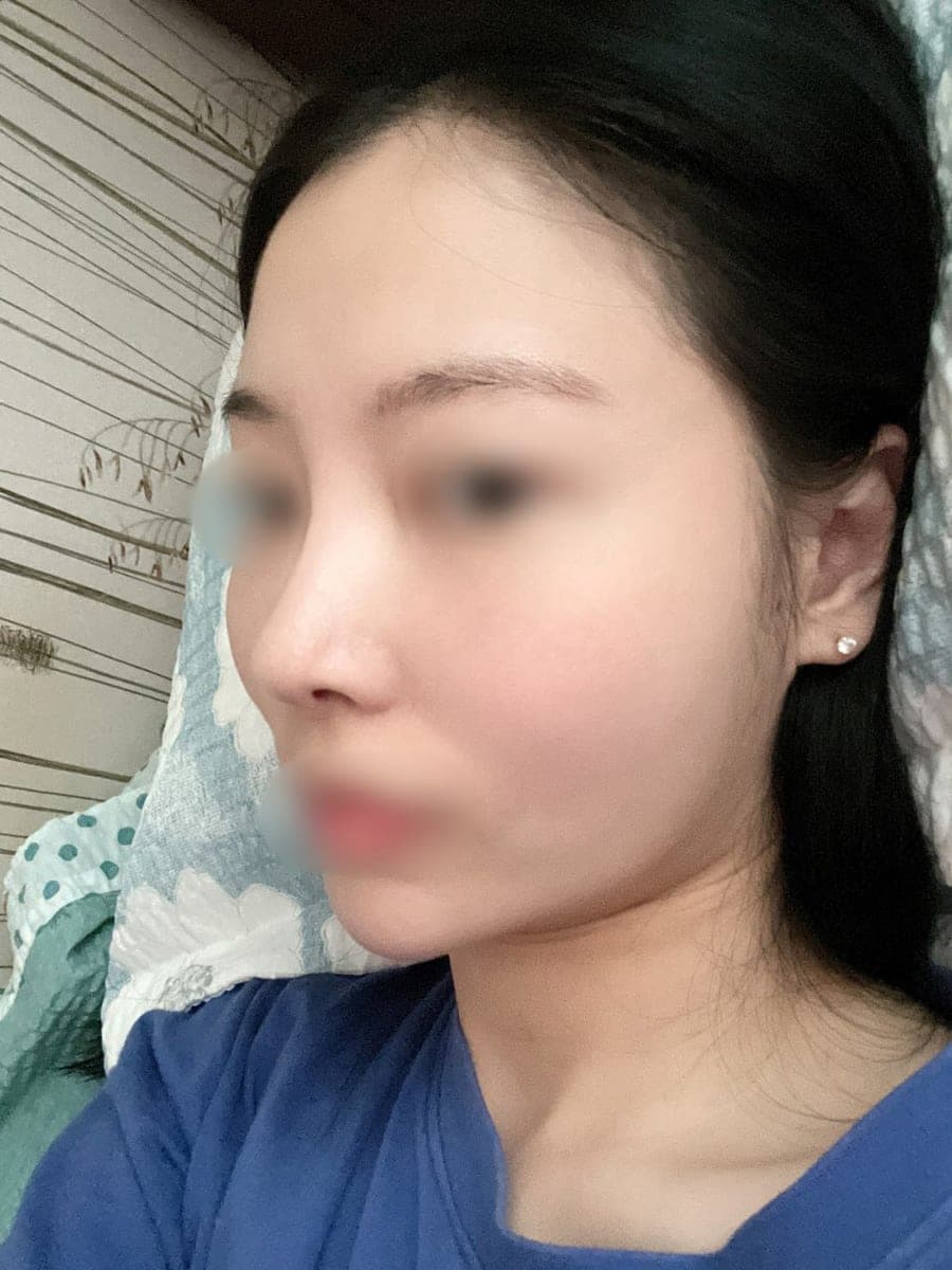 Less visible nostrils, tip with own cartilage