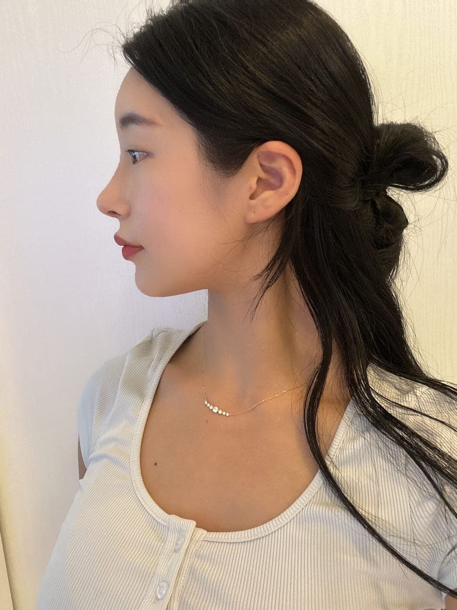 Refining the tip line with own cartilage