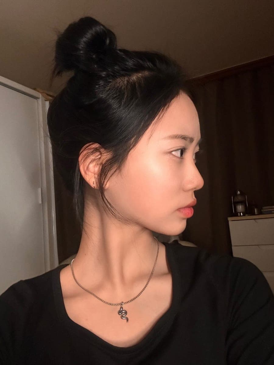 เสริมสันจมูกด้วยกระดูกอ่อนตัวเอง